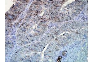 Immunohistochemistry analysis using Mouse Anti-Hsp90 Monoclonal Antibody, Clone D7alpha (ABIN361792 and ABIN361793).