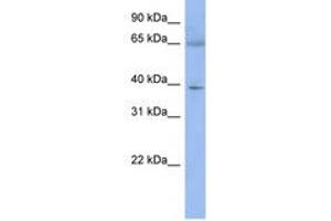 Image no. 1 for anti-Zinc Finger Protein 302 (ZNF302) (N-Term) antibody (ABIN6742848) (ZNF302 Antikörper  (N-Term))