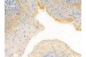 anti-Phosphoinositide-3-Kinase, Class 2, alpha Polypeptide (PIK3C2A) (C-Term) antibody