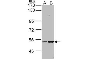 WB Image Sample (30 ug of whole cell lysate) A: Molt-4 , B: Raji 7.