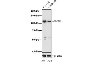 Western blot analysis of extracts of 293T cells, using IGF1R antibody (ABIN3020767, ABIN3020768, ABIN3020769 and ABIN6213714) at 1:3000 dilution. (IGF1R Antikörper  (AA 660-760))