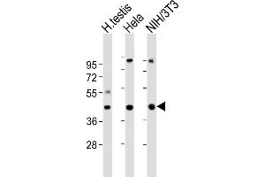Western Blotting (WB) image for anti-Guanine Nucleotide Binding Protein (G Protein), alpha 11 (Gq Class) (GNA11) (AA 115-146) antibody (ABIN6243772)