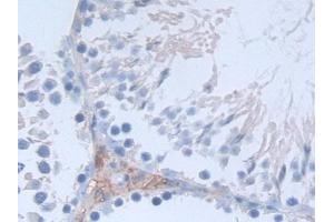 Detection of SDC1 in Rat Testis Tissue using Polyclonal Antibody to Syndecan 1 (SDC1) (Syndecan 1 Antikörper  (AA 58-313))