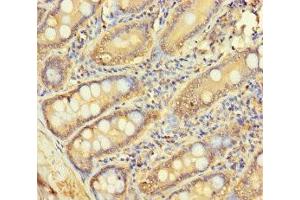 Immunohistochemistry of paraffin-embedded human small intestine tissue using ABIN7158841 at dilution of 1:100 (LOXL3 Antikörper  (AA 401-608))