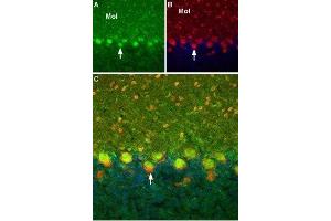 Expression of TRPC6 in rat cerebellumImmunohistochemical staining of rat cerebellum using Guinea pig Anti-TRPC6 Antibody (ABIN7043826, ABIN7045362 and ABIN7045363).