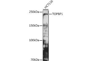 Western blot analysis of extracts of HCT116 cells, using TOPBP1 antibody (ABIN6129493, ABIN6149398, ABIN6149401 and ABIN6221465) at 1:500 dilution.