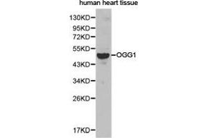 Western Blotting (WB) image for anti-8-Oxoguanine DNA Glycosylase (OGG1) antibody (ABIN1873998) (OGG1 Antikörper)