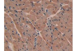 DAB staining on IHC-P; Samples: Mouse Heart Tissue (ATP2B2 Antikörper  (AA 417-830))
