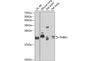 Western blot analysis of extracts of various cell lines, using R antibody (ABIN6128595, ABIN6146569, ABIN6146571 and ABIN6220321) at 1:1000 dilution. (RAB31 Antikörper  (AA 1-195))