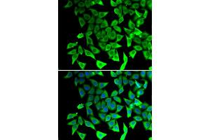 Immunofluorescence analysis of A549 cells using PTGES2 antibody. (PTGES2 Antikörper)