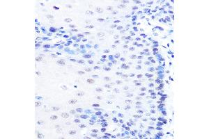 Immunohistochemistry (IHC) image for anti-Microphthalmia-Associated Transcription Factor (MITF) antibody (ABIN7268511)