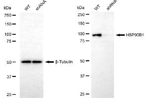 Western blotting analysis using HSP90B1 antibody (ABIN7798876).