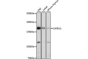 Western blot analysis of extracts of various cell lines, using C antibody (ABIN6127550, ABIN6137939, ABIN6137940 and ABIN6222956) at 1:1000 dilution. (CARD11 Antikörper  (AA 985-1154))