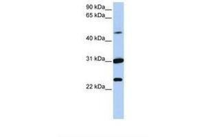 Image no. 1 for anti-Membrane transport protein XK (XK) (AA 72-121) antibody (ABIN6737735) (Membrane transport protein XK (XK) (AA 72-121) Antikörper)