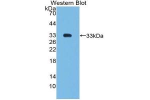 Western blot analysis of the recombinant protein. (SMAD6 Antikörper  (AA 171-441))