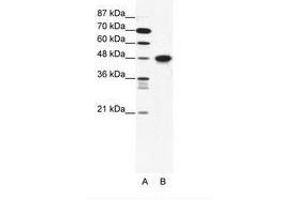 Image no. 1 for anti-Enolase 1 (ENO1) (N-Term) antibody (ABIN202517) (ENO1 Antikörper  (N-Term))