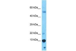 Host:  Rabbit  Target Name:  PAGE4  Sample Type:  Thymus Tumor lysates  Antibody Dilution:  1. (PAGE4 Antikörper  (N-Term))