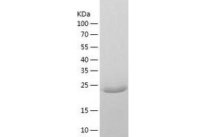 CLIC2 Protein (AA 1-247) (His tag)