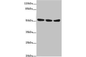Western blot All lanes: KYNU antibody at 1. (KYNU Antikörper  (AA 1-307))