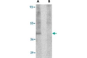 Western blot analysis of RIMS3 in human brain tissue lysate with RIMS3 polyclonal antibody  at 1 ug/mL in the (A) absence and (B) presence of blocking peptide. (RIMS3 Antikörper  (N-Term))