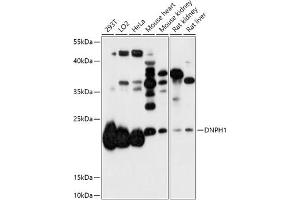 Western blot analysis of extracts of various cell lines, using DNPH1 antibody (ABIN7266384) at 1:1000 dilution.