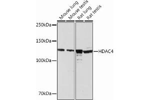 Western blot analysis of extracts of various cell lines, using HD Rabbit mAb (ABIN6132653, ABIN6147718, ABIN6147719 and ABIN7101423) at 1:1000 dilution. (HDAC4 Antikörper)