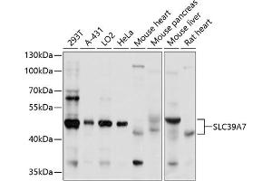 Western blot analysis of extracts of various cell lines, using SLC39 antibody (ABIN1682785, ABIN3017729, ABIN3017730 and ABIN6220217) at 1:1000 dilution. (SLC39A7 Antikörper  (AA 235-380))