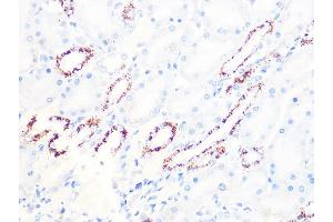 Immunohistochemistry of paraffin-embedded rat kidney using PDHB Rabbit mAb (ABIN7269772) at dilution of 1:100 (40x lens). (PDHB Antikörper)