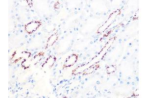 Immunohistochemistry of paraffin-embedded rat kidney using PDHB Rabbit mAb (ABIN7269772) at dilution of 1:100 (40x lens).