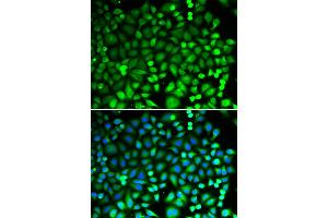 Immunofluorescence analysis of MCF-7 cells using PSMB2 antibody (ABIN6291444). (PSMB2 Antikörper)