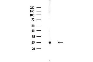anti-MOB1, Mps One Binder Kinase Activator-Like 2C (MOBKL2C) (Internal Region) antibody