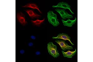 ABIN6264513 and ABIN6273302 staining Hela cells by IF/ICC.