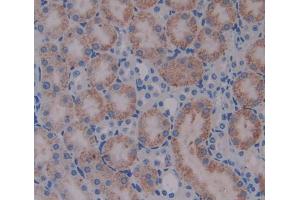 Used in DAB staining on fromalin fixed paraffin- embedded kidney tissue (alpha Adducin Antikörper  (AA 388-560))