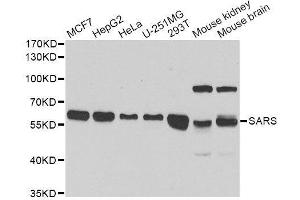 Western blot analysis of extracts of various cell lines, using SARS antibody. (Seryl-tRNA Synthetase (SARS) (AA 1-300) Antikörper)