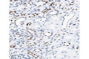 ABIN6266610 at 1/100 staining human kidney tissue sections by IHC-P. (KAT2B Antikörper  (C-Term))