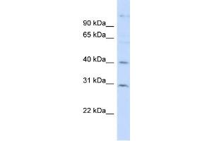 WB Suggested Anti-FAM50B Antibody Titration: 0. (FAM50B Antikörper  (N-Term))