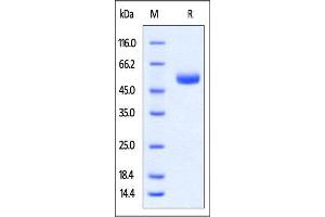 Rabbit CTLA-4 Protein, Fc Tag on SDS-PAGE under reducing (R) condition. (CTLA4 Protein (AA 36-161) (Fc Tag))