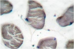 Image no. 1 for anti-Actin, alpha 1, Skeletal Muscle (ACTA1) antibody (ABIN265299) (Actin Antikörper)