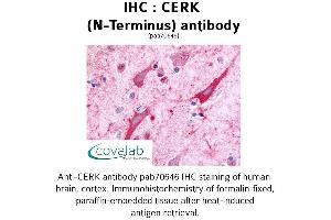 Image no. 1 for anti-Ceramide Kinase (CERK) (Extracellular Domain), (N-Term) antibody (ABIN1733020) (CERK Antikörper  (Extracellular Domain, N-Term))