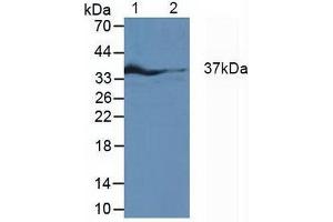 Western blot analysis of (1) Rat Fetal Rat Tissue, (2) Rat Heart Tissue and (3) Rat Placenta Tissue. (IRF1 Antikörper  (AA 11-276))