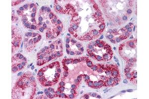 Immunohistochemistry (IHC) image for anti-Tumor Protein P53 (TP53) (N-Term) antibody (ABIN2779317) (p53 Antikörper  (N-Term))