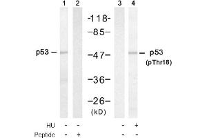 Image no. 1 for anti-Tumor Protein P53 (TP53) (Thr18) antibody (ABIN319304) (p53 Antikörper  (Thr18))