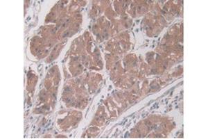 DAB staining on IHC-P Samples:Human Stomach Tissue) (PAI1 Antikörper  (AA 25-402))
