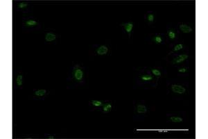 Immunofluorescence of monoclonal antibody to MEOX1 on HeLa cell. (MEOX1 Antikörper  (AA 82-170))