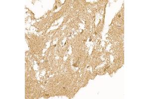 Immunohistochemistry of paraffin-embedded human brain using RC Rabbit pAb (ABIN6129452, ABIN6146811, ABIN6146812 and ABIN6220955) at dilution of 1:150 (40x lens). (RCAN1 Antikörper  (AA 60-245))