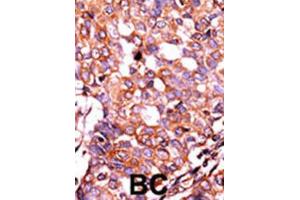 Immunohistochemistry (IHC) image for anti-LPR1 (pSer4520) antibody (ABIN3001761) (LPR1 (pSer4520) Antikörper)