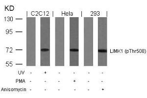 Western blot analysis of extracts from UV-treated C2C12, PMA-treated Hela and anisomycin-treated 293 cells using LIMK1(Phospho-Thr508) Antibody. (LIM Domain Kinase 1 Antikörper  (pThr508))