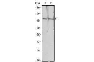 Western Blot showing HDAC4 antibody used against Hela (1), Jurkat (2) cell lysate. (HDAC4 Antikörper)