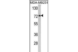 Western blot analysis of FMO3 Antibody (N-term) (ABIN390888 and ABIN2841098) in MDA-M cell line lysates (35 μg/lane).