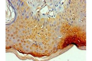 Immunohistochemistry of paraffin-embedded human skin tissue using ABIN7156454 at dilution of 1:100 (ITGA9 Antikörper  (AA 30-250))